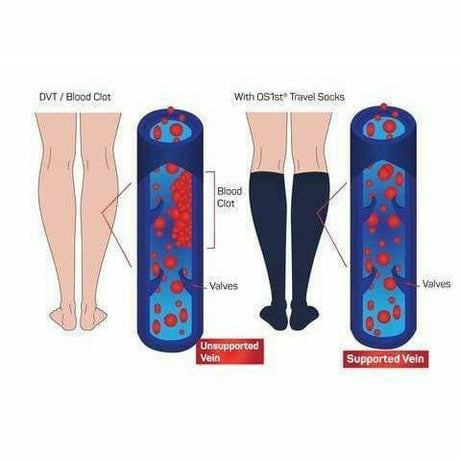 OS1st Travel Compression Over-the-Calf Socks  - 